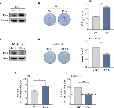 DNA Polymerase <mark class="highlighted">Iota</mark> Promotes Esophageal Squamous Cell Carcinoma Proliferation Through Erk-OGT-Induced G6PD Overactivation